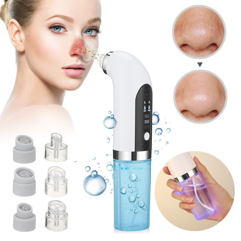 Automatic Blackhead Remover